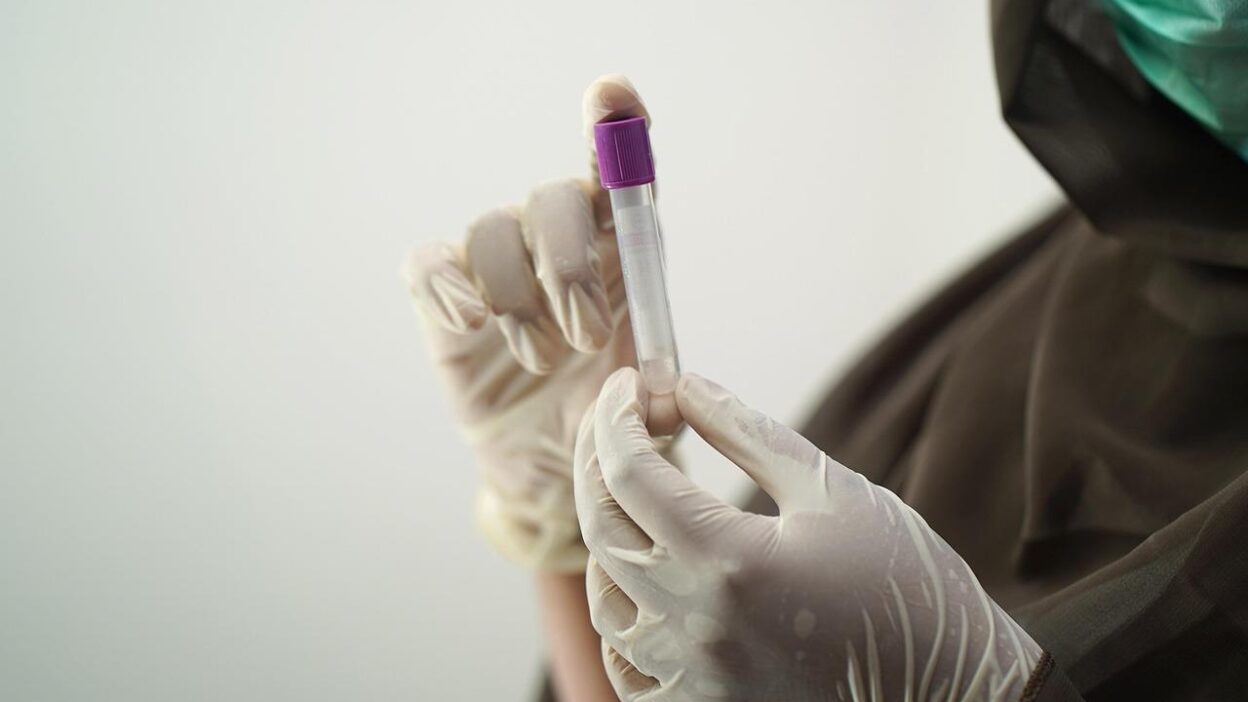 Decoding Female Hormone Blood Test Results for Better Health