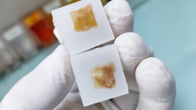 How Reliable Are Preserved Tissue Specimens for Retrospective Studies