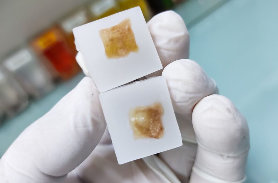 How Reliable Are Preserved Tissue Specimens for Retrospective Studies