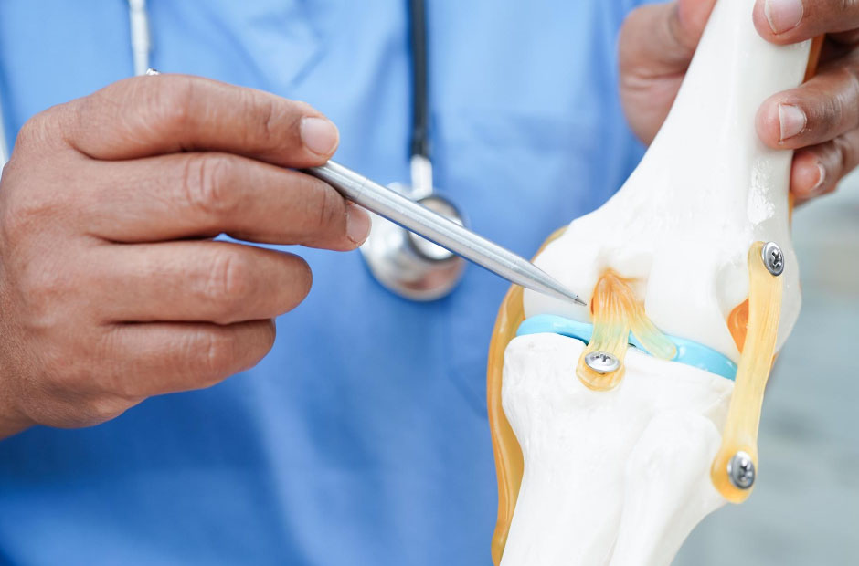 Understanding Knee Replacement Surgery