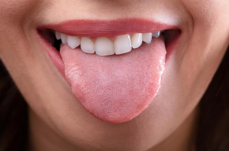 What Your Tongue Can Reveal About Oral Health