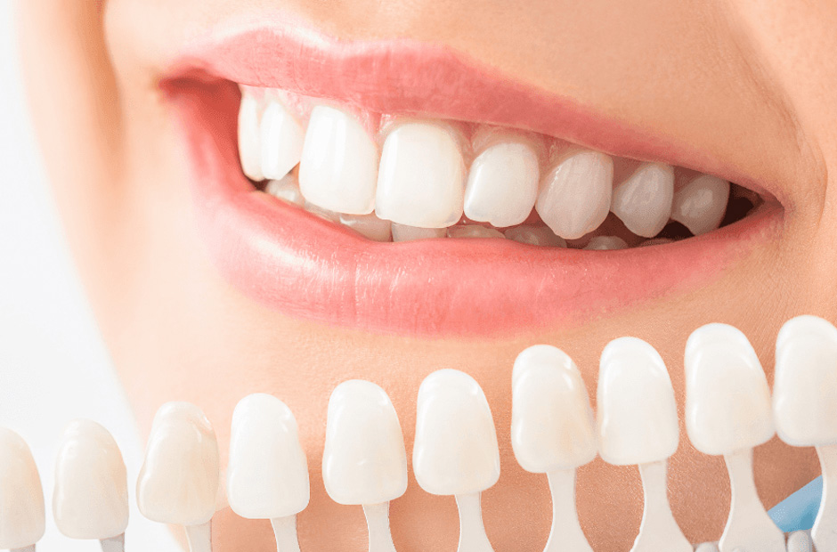 Temporary vs. Permanent Dental Crowns in Richardson – Whats the Difference