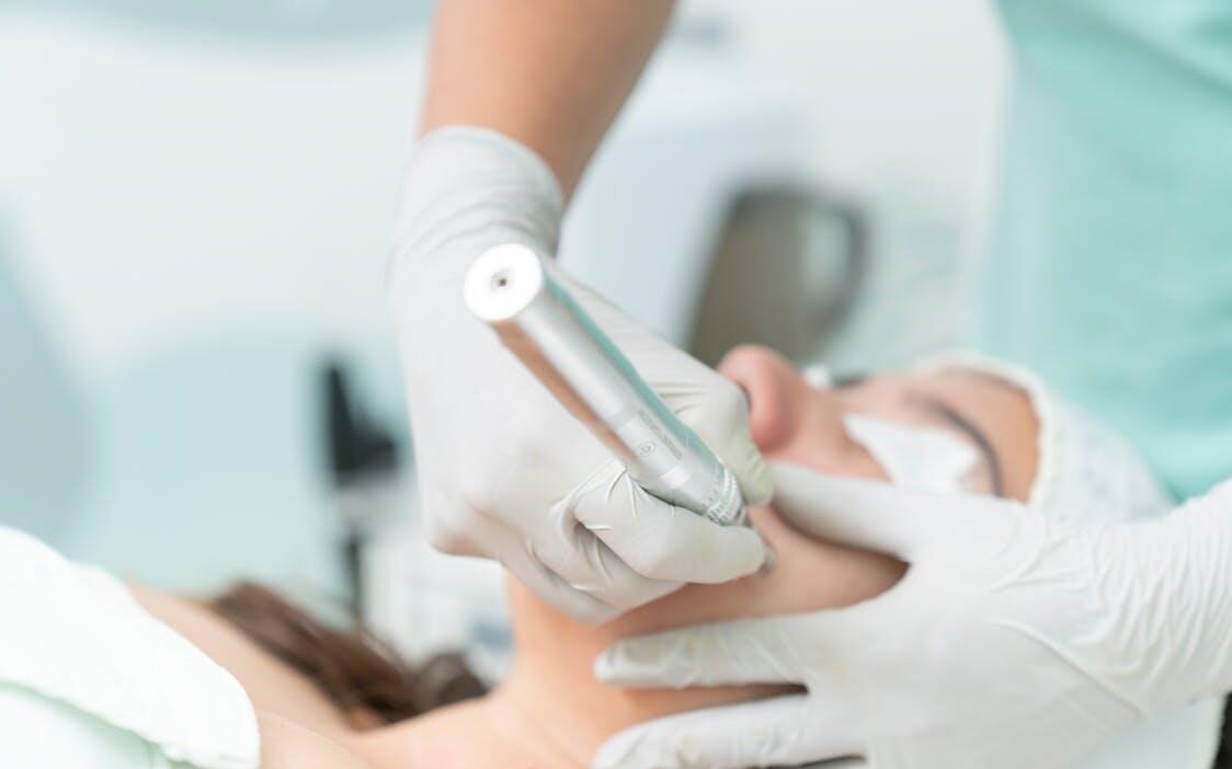 A Simple Guide to Microneedling for Healthier Skin