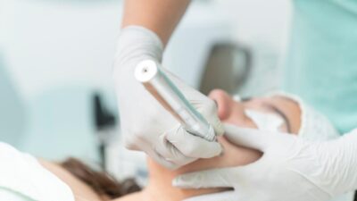 A Simple Guide to Microneedling for Healthier Skin