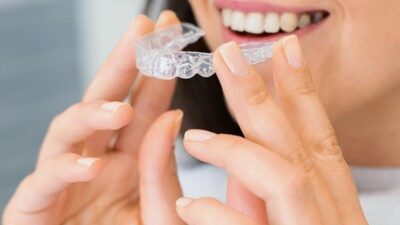 The Benefits of Choosing Clear Aligners for a Better Smile