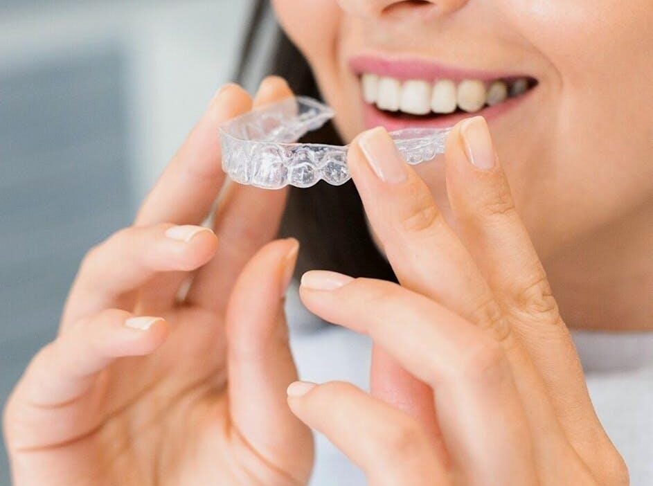 The Benefits of Choosing Clear Aligners for a Better Smile